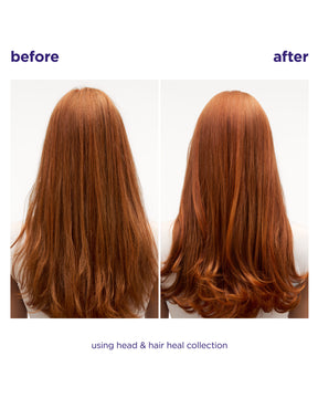Head & Hair Heal Soothing Serum