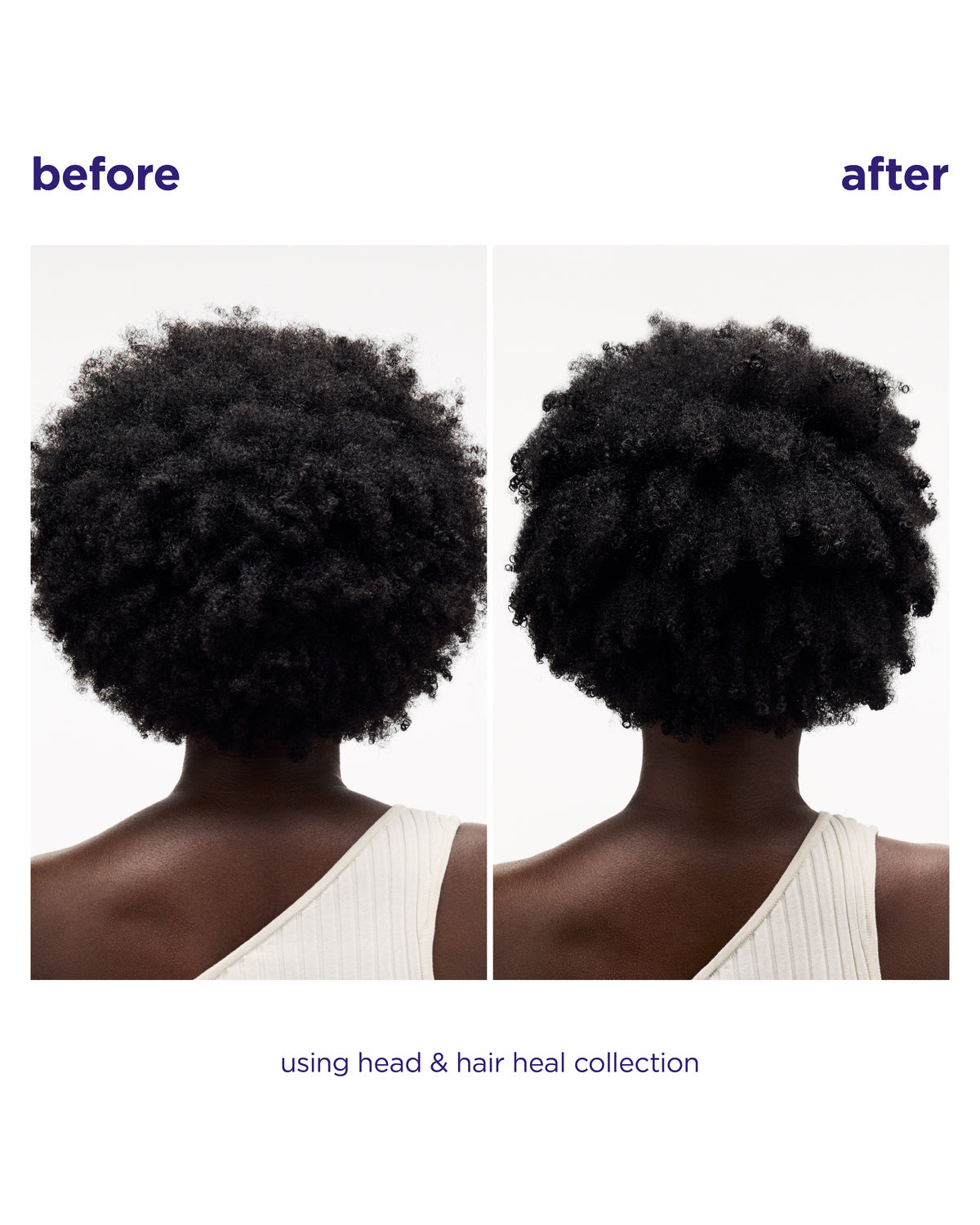 Head & Hair Heal Soothing Serum